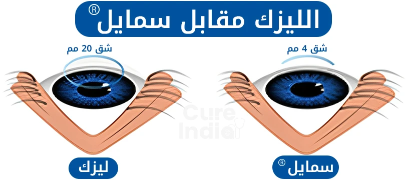 ابتسامة مقابل جراحة العيون بالليزر